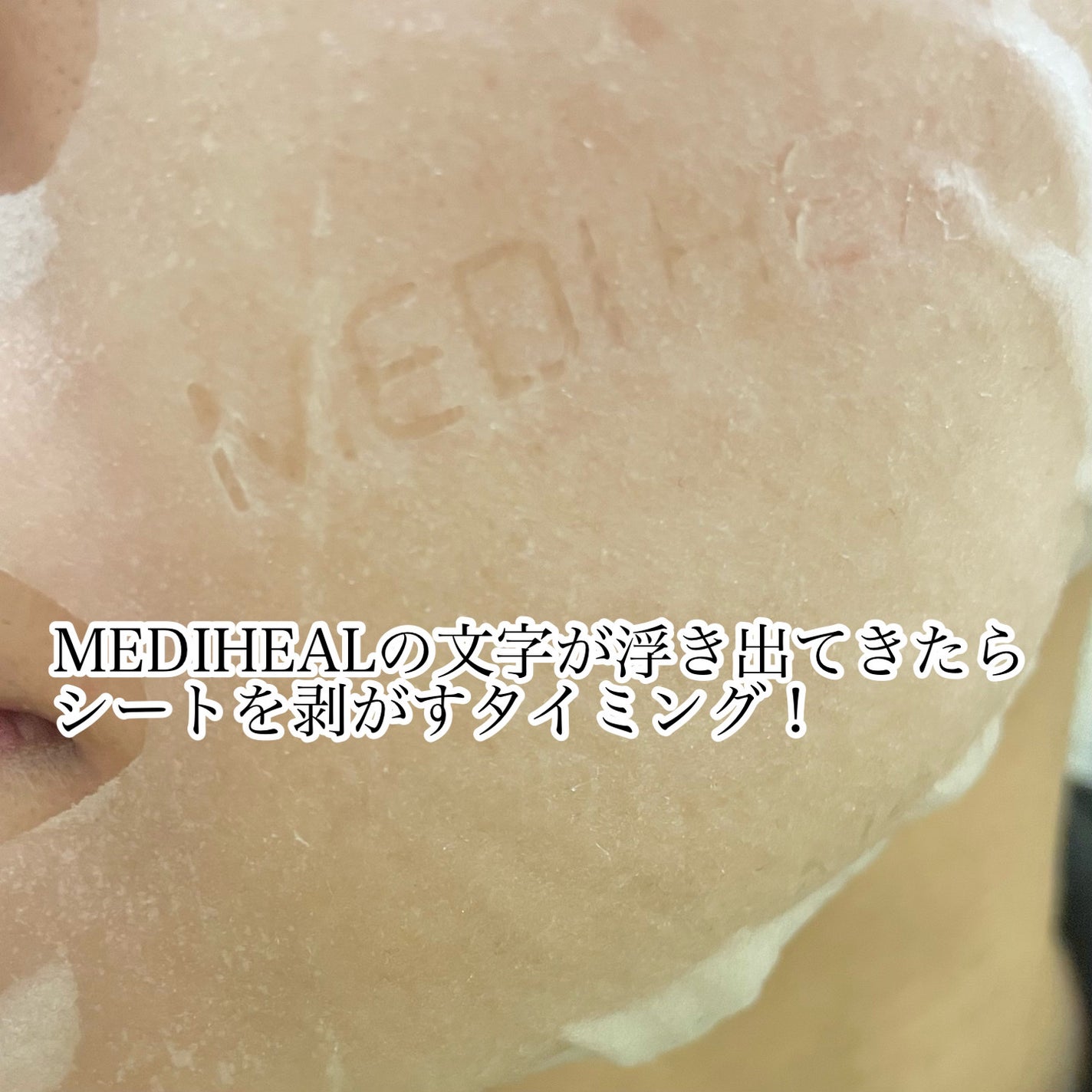 THE ティーツリー APマスク JEX/MEDIHEAL/シートマスク・パックを使ったクチコミ(4枚目)