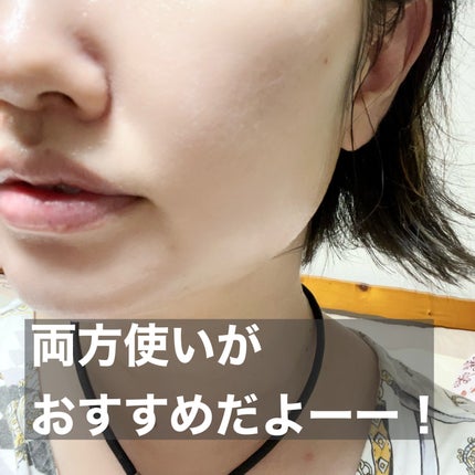 ノスカナイン トラブル セラム/FATION/美容液を使ったクチコミ(4枚目)