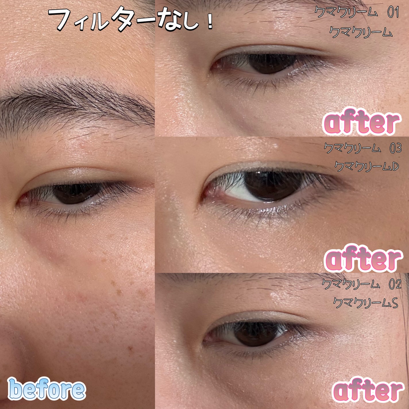 アイレノール クマクリーム/IRENOL/アイケア・アイクリームを使ったクチコミ(4枚目)