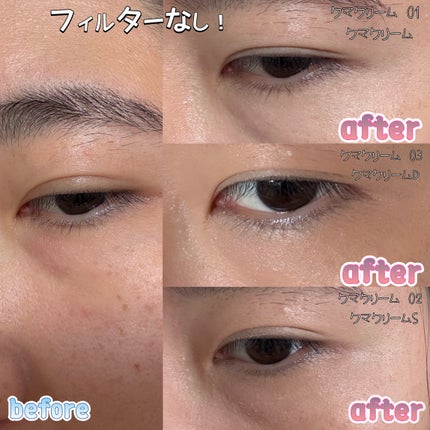 アイレノール クマクリーム/IRENOL/アイケア・アイクリームを使ったクチコミ(4枚目)