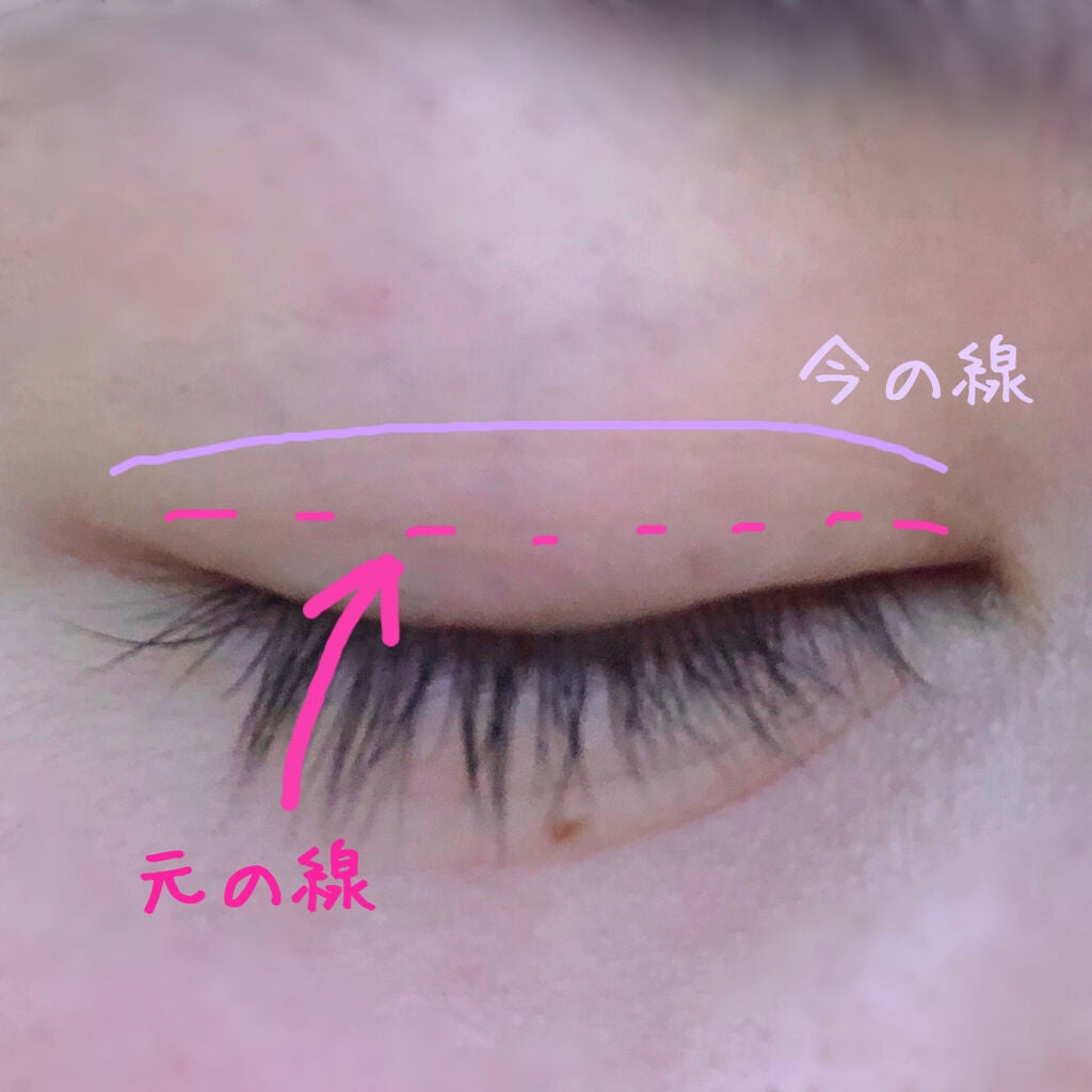 オリシキ アイリッドスキンフィルム /D-UP/二重まぶた用アイテムを使ったクチコミ(4枚目)