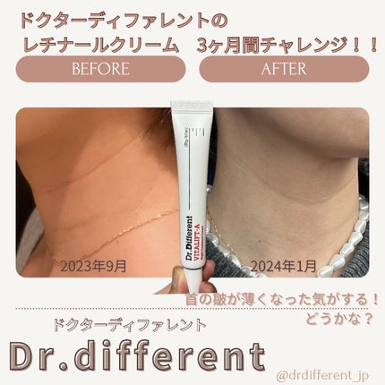 VITALIFT A forte/Dr.Different/フェイスクリームを使ったクチコミ(3枚目)