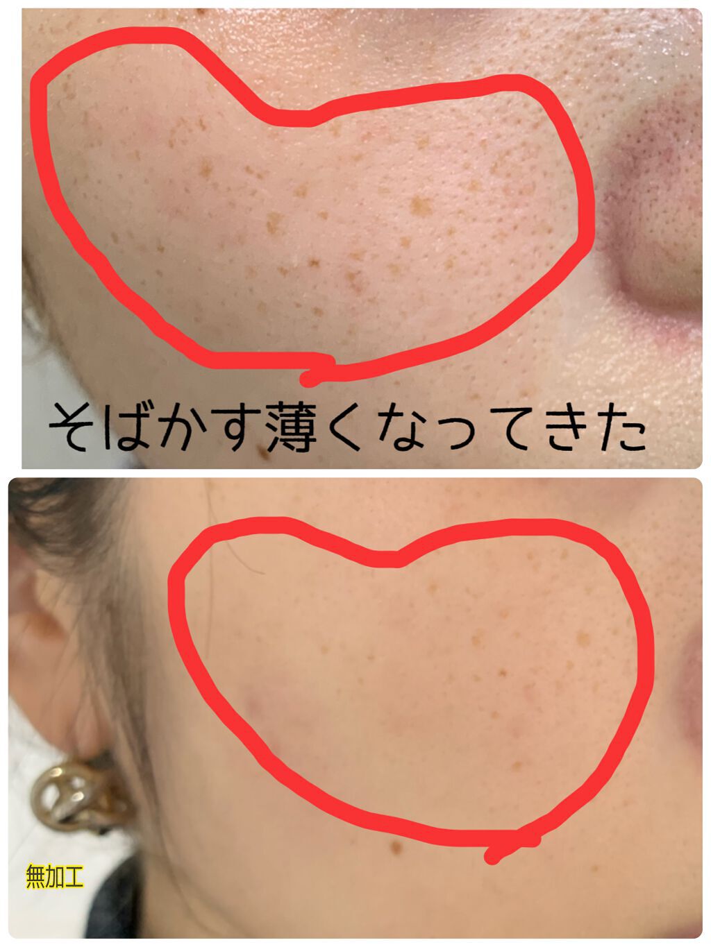 薬用 雪肌精/雪肌精/化粧水を使ったクチコミ(1枚目)