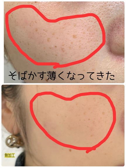 薬用 雪肌精/雪肌精/化粧水を使ったクチコミ(1枚目)