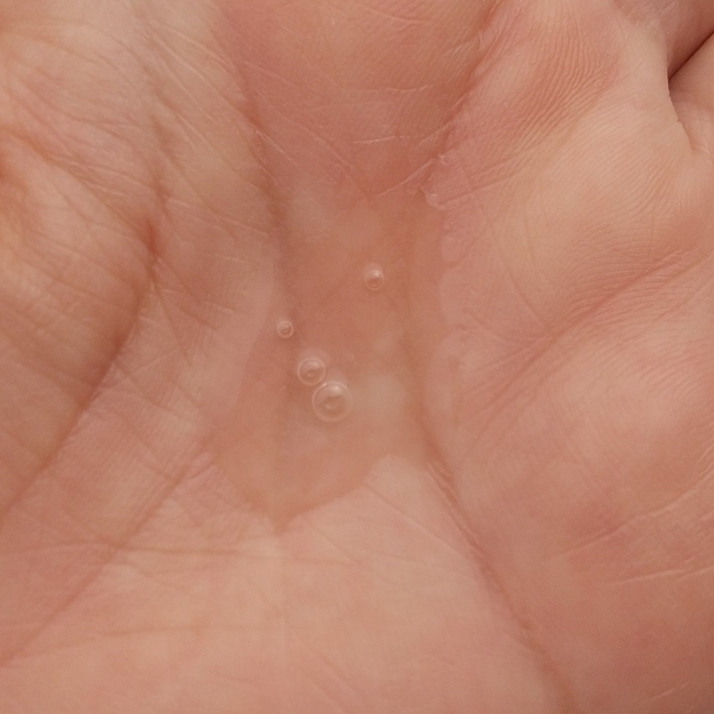 マデカデイリーリペアアンプル/センテリアン24/美容液を使ったクチコミ(3枚目)