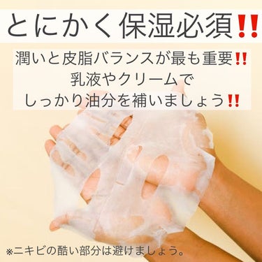 ロゼット洗顔パスタ アクネクリア/ロゼット/洗顔フォームを使ったクチコミ（2枚目）