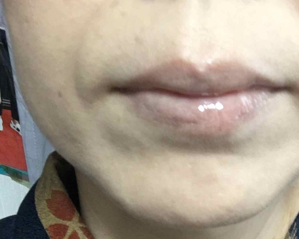 【旧】ディオール アディクト リップ マキシマイザー/Dior/リップグロスを使ったクチコミ（3枚目）