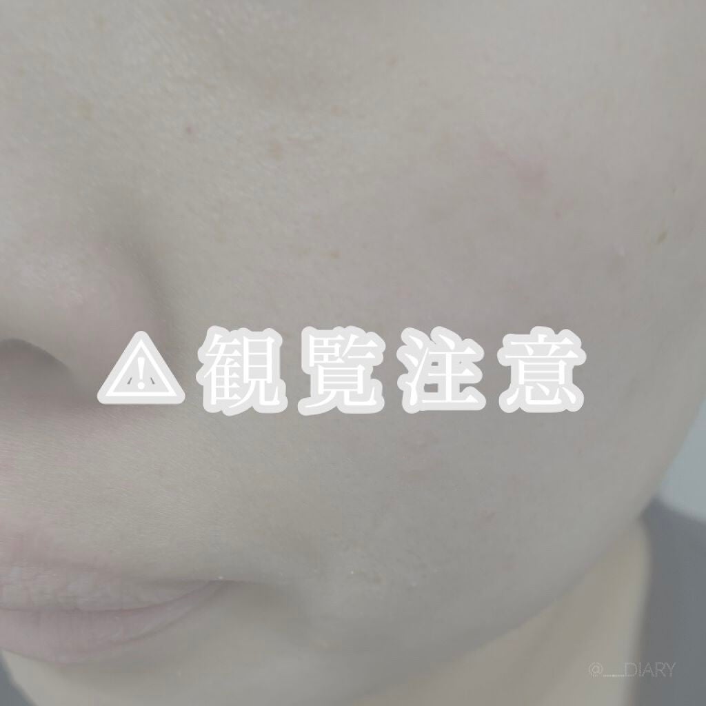 デュオ ザ クレンジングバーム ブラックリペア /DUO/クレンジングバームを使ったクチコミ(2枚目)