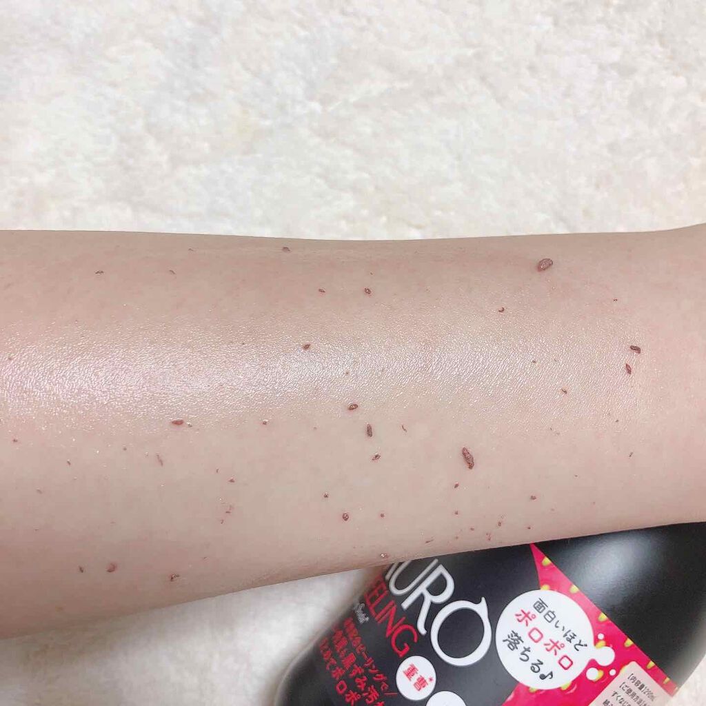 JUSO KURO PEELING（重曹配合ピーリングジェル）/NAKUNA-RE/ピーリングを使ったクチコミ（3枚目）