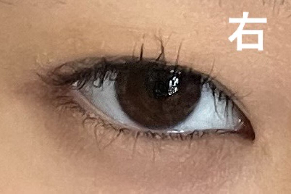 TWOOLダブルアイリッドハイブリットフィルム/SHOBIDO/二重まぶた用アイテムを使ったクチコミ（1枚目）