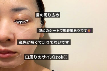 MEDIHEAL ヒアルモイストエッセンスマスクのクチコミ「#MEDIHEAL
Hyalu Moist Essense Mask

効果
#水分補給
#水.....」（2枚目）