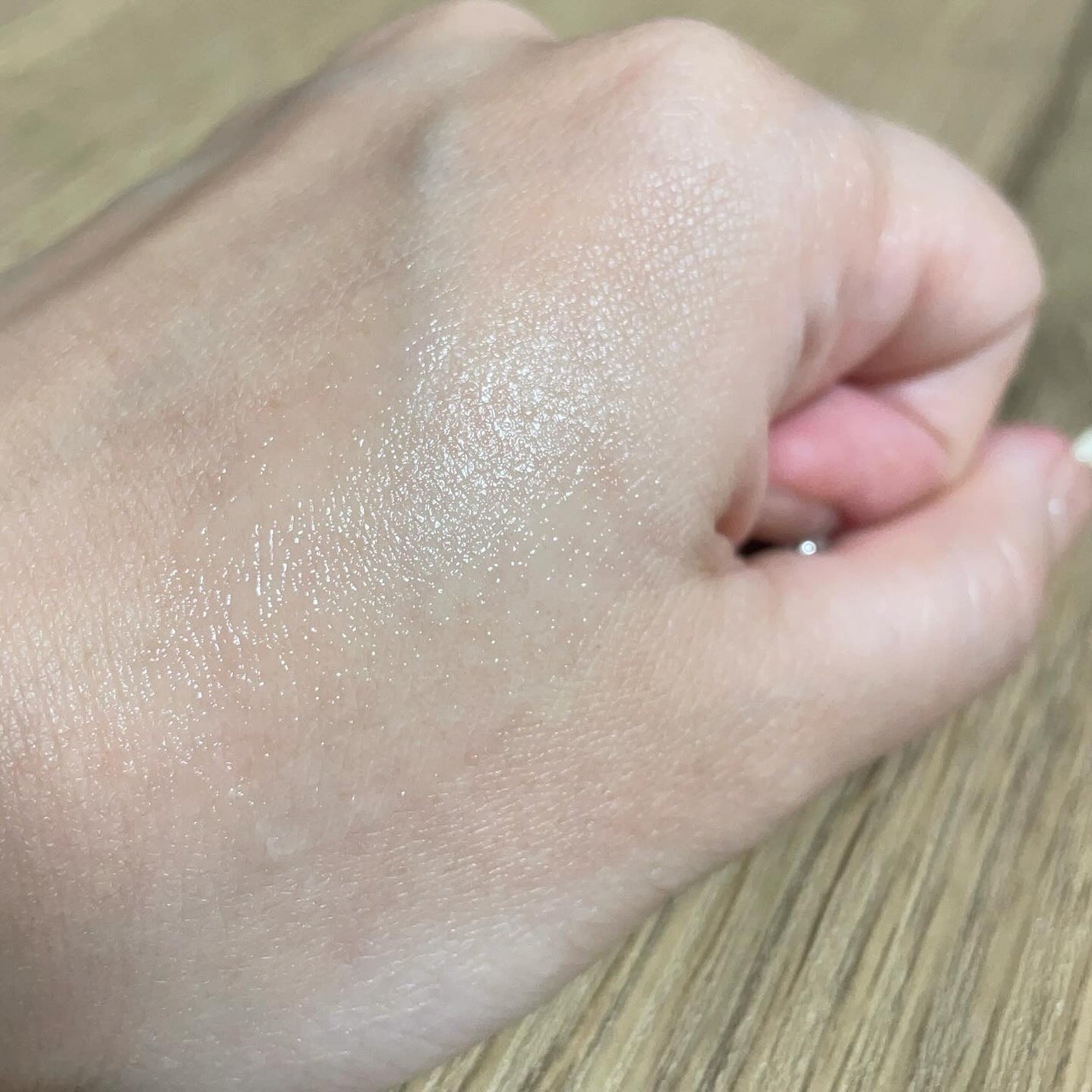 HiCA AZAリペアクリーム アゼライン酸10%/HiCA/フェイスクリームを使ったクチコミ(3枚目)