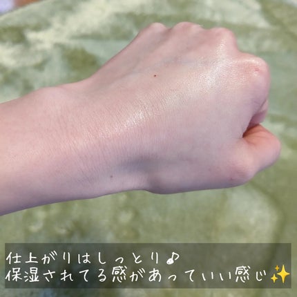 ドクダミ 77 スージングトナー/Anua/化粧水を使ったクチコミ(5枚目)