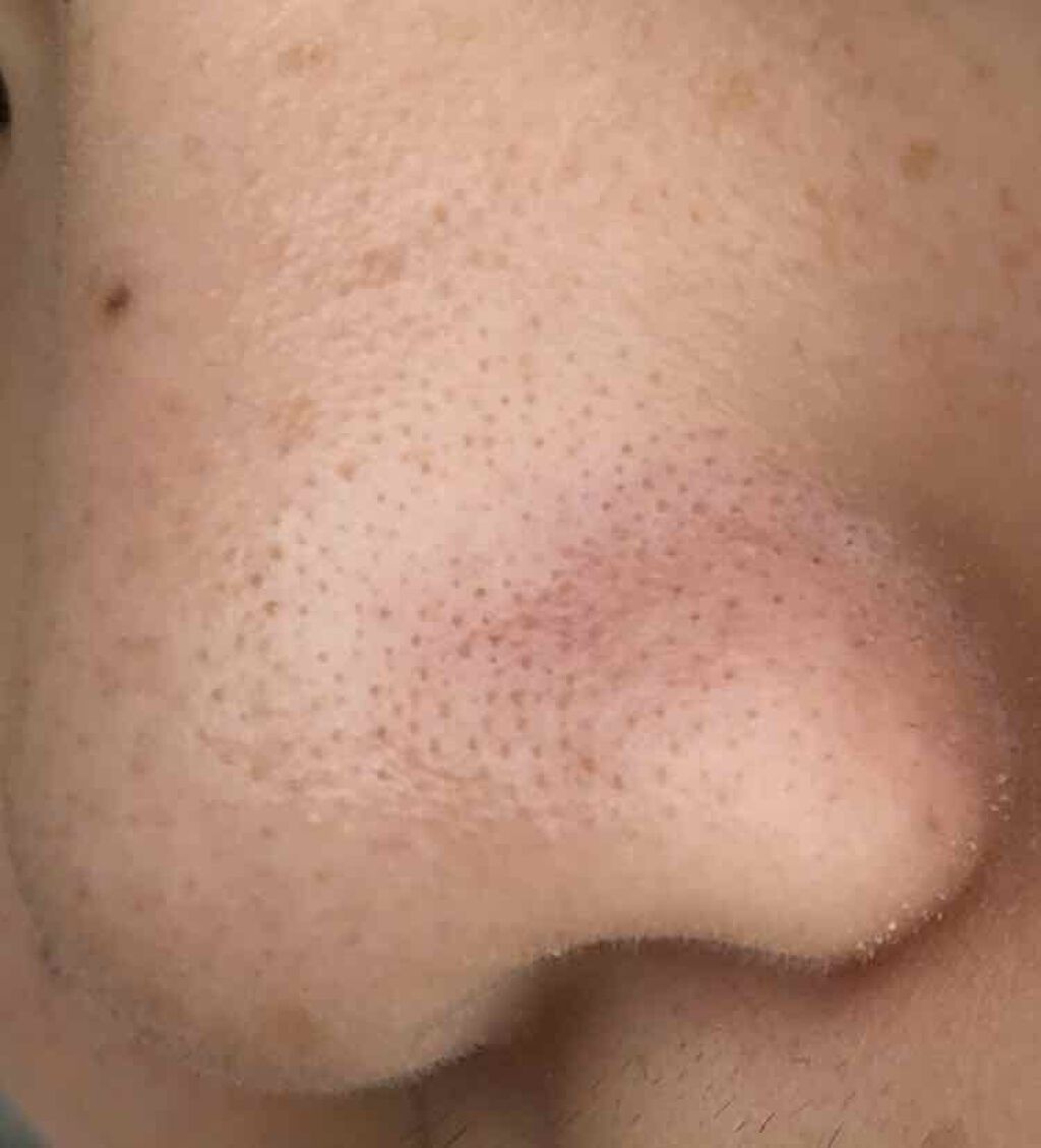 ジョンソンベビーオイル微香性/ジョンソンベビー/ボディオイルを使ったクチコミ(2枚目)