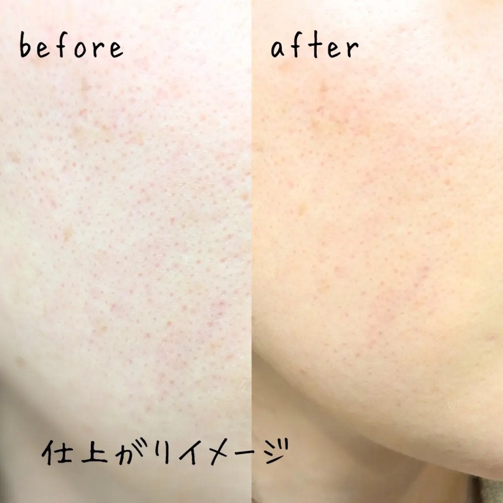 アスタリフト ホワイト ジェリー アクアリスタ/アスタリフト/美容液を使ったクチコミ(6枚目)