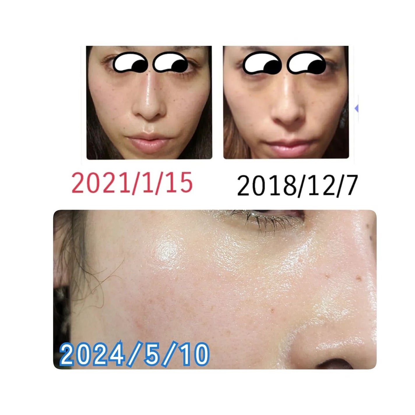 白潤 薬用美白化粧水(しっとりタイプ)/肌ラボ/化粧水を使ったクチコミ(9枚目)