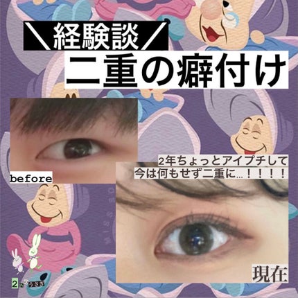 アイプチ リキッドテープN/アイプチ®/二重まぶた用アイテムを使ったクチコミ(1枚目)