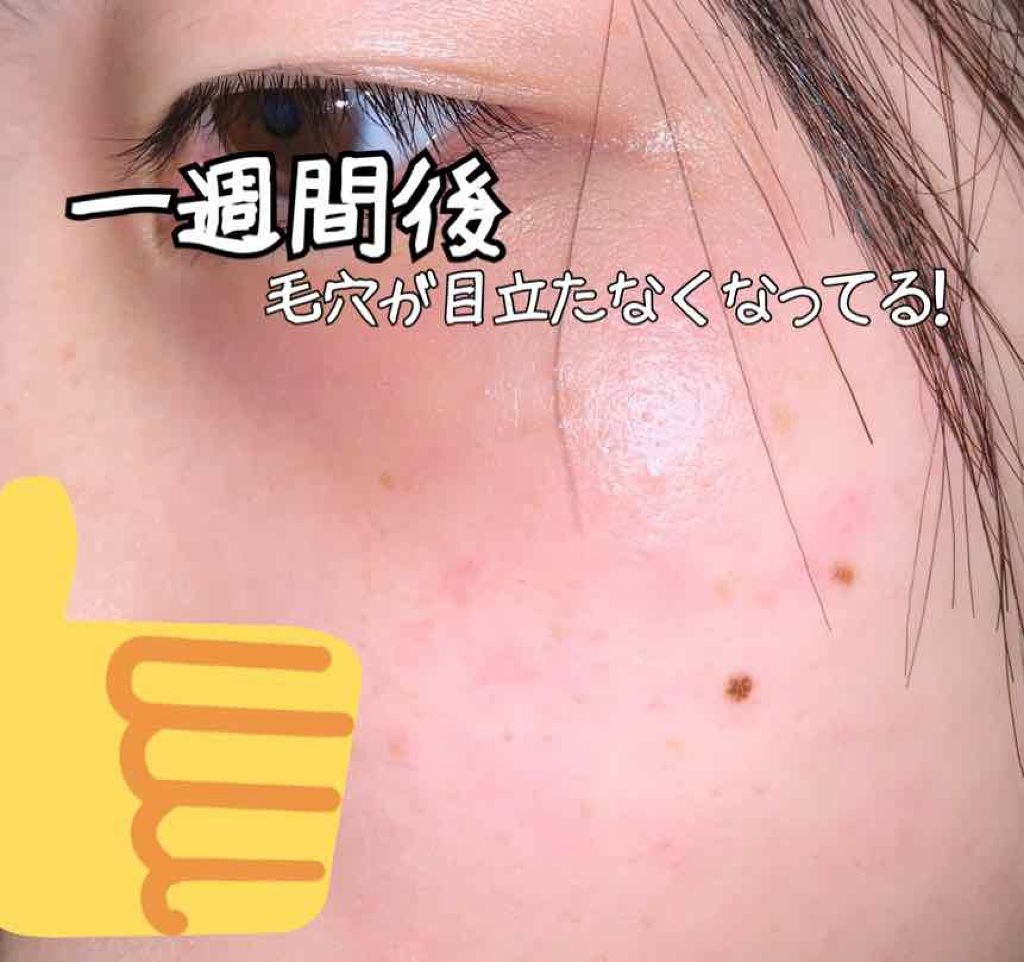 オーガニック炭酸ホワイトパック/Sing/洗い流すパック・マスクを使ったクチコミ(4枚目)