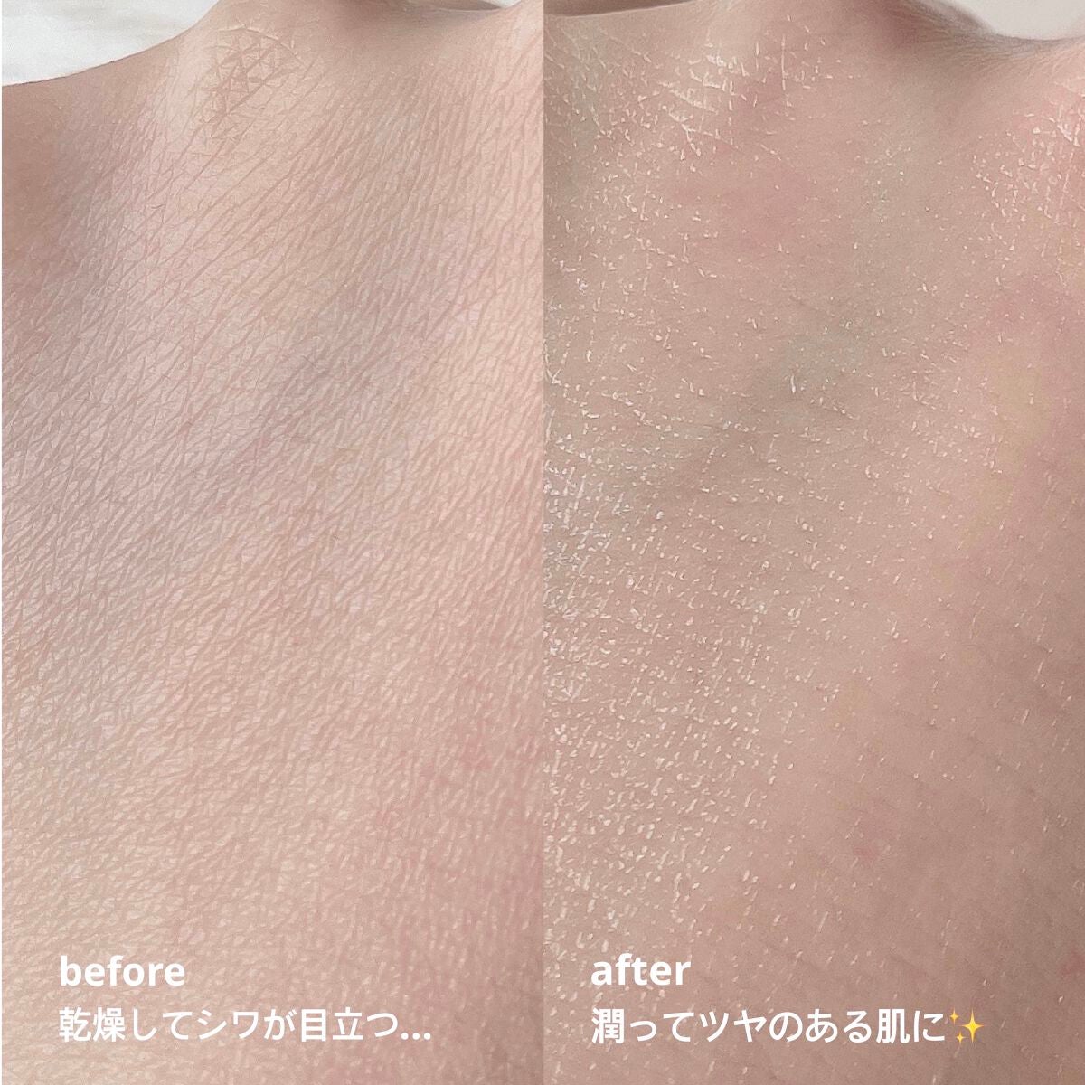 マデカバイタルカプセルセラム/センテリアン24/美容液を使ったクチコミ(6枚目)