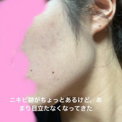白潤プレミアム 薬用浸透美白化粧水(しっとりタイプ)/肌ラボ/化粧水を使ったクチコミ(1枚目)