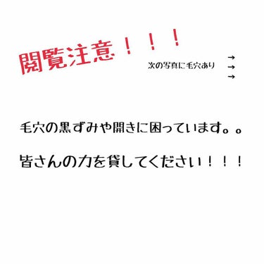 ロゼットゴマージュ/ロゼット/ピーリングを使ったクチコミ（1枚目）