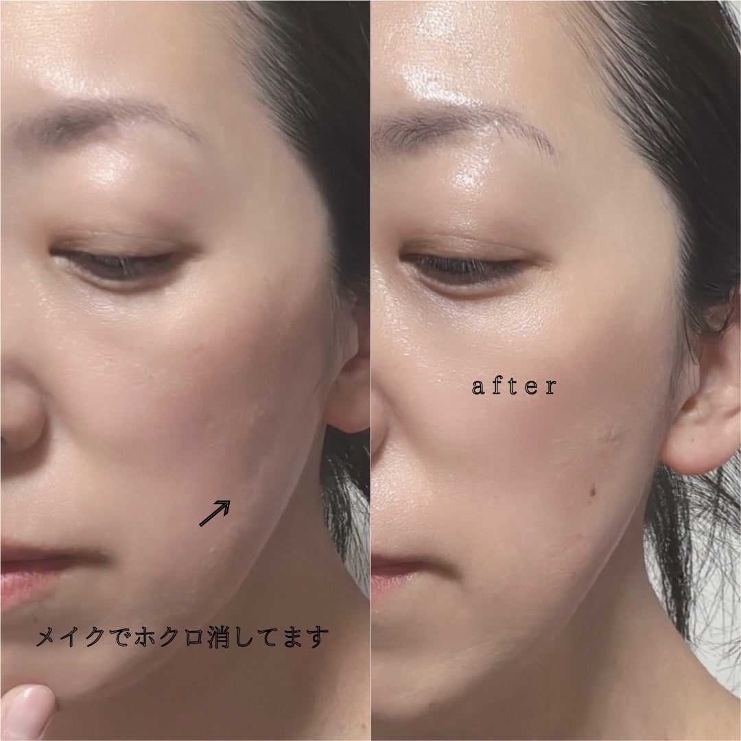 9番 NMNバイオリフトラッピングマスク/numbuzin/シートマスク・パックを使ったクチコミ(5枚目)