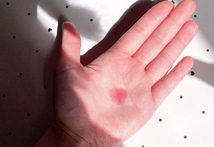 アンチリンクルエフェクトアンプルオリジン/MIGUHARA/美容液を使ったクチコミ(3枚目)