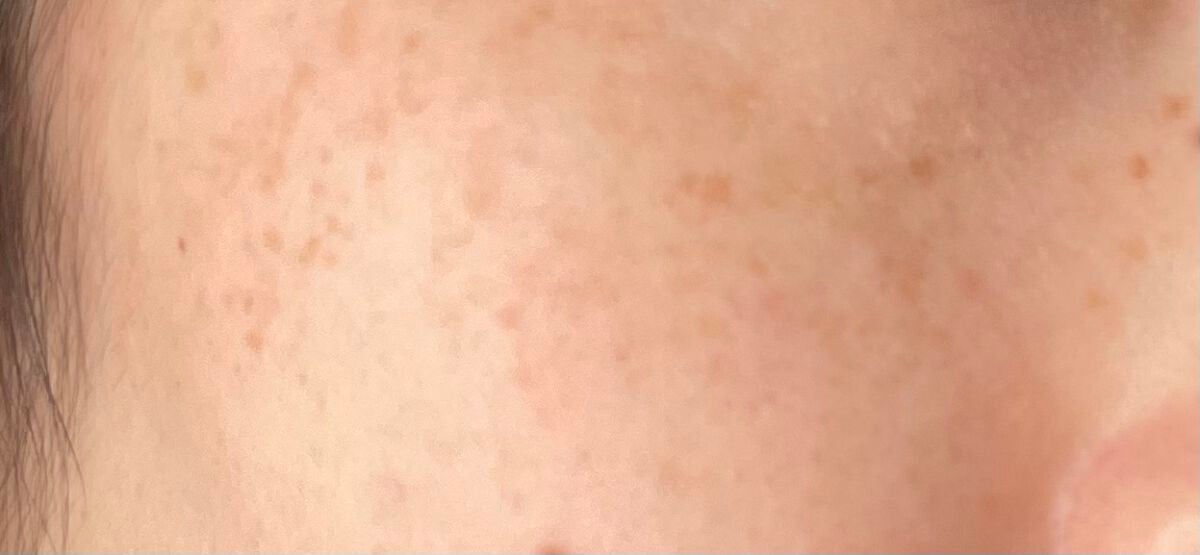 カラーミキシングコンシーラー/キャンメイク/パレットコンシーラーを使ったクチコミ(5枚目)