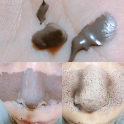 ツルリ 皮脂吸い出し 部分用パック ガスール&レッドパワー/ツルリ/洗い流すパック・マスクを使ったクチコミ(2枚目)