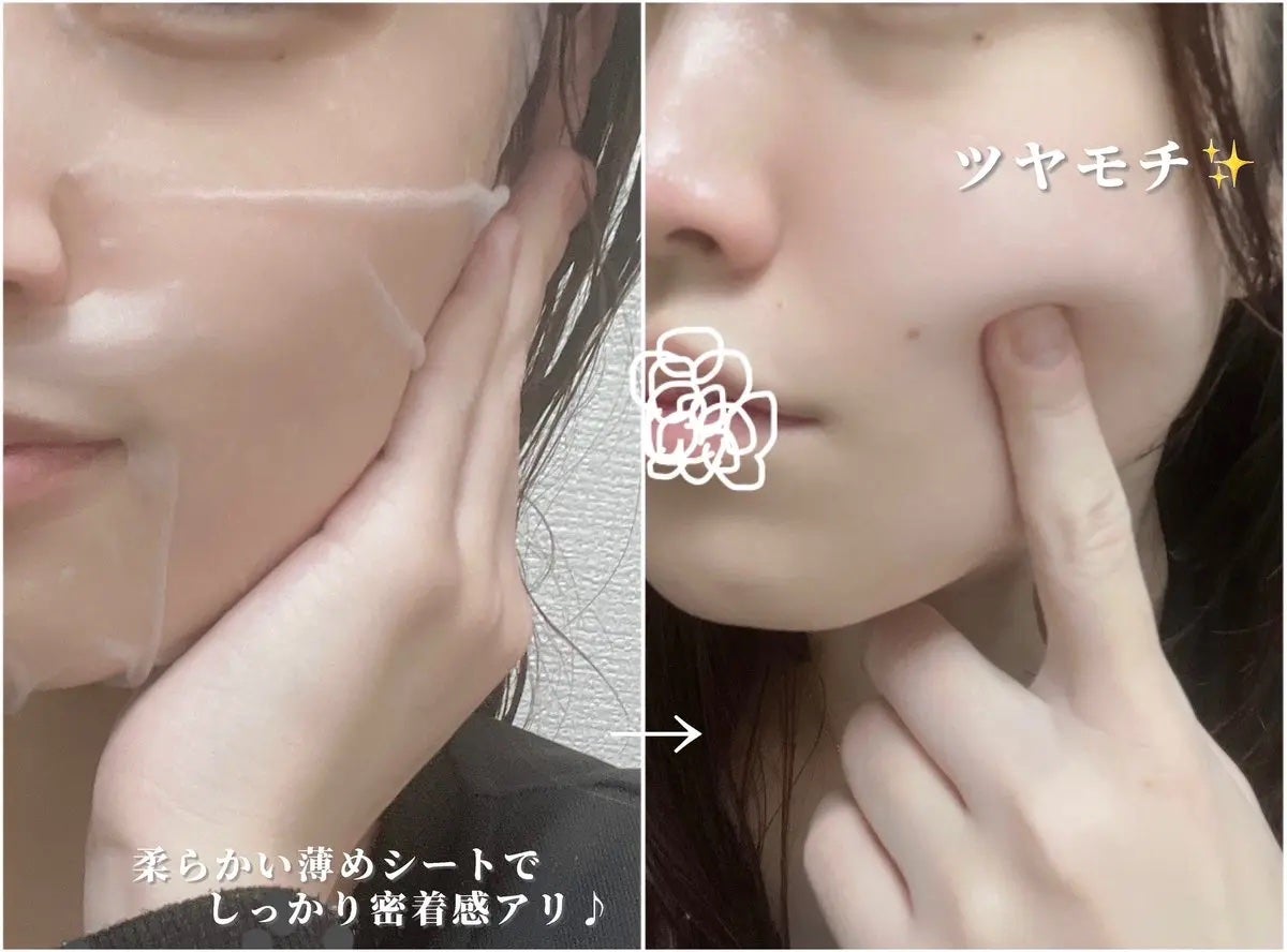 レチララ デイリーシートマスク/ネイチャーリパブリック/シートマスク・パックを使ったクチコミ(2枚目)