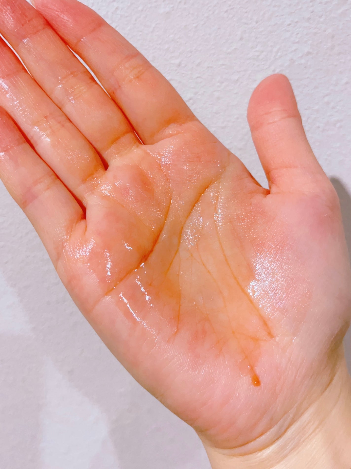 レッドアクネ ボディピーリングショット/MEDICUBE/ピーリングを使ったクチコミ(3枚目)