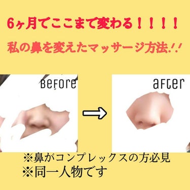 ﾋ ﾅ ｺ .ᐟ.ᐟ on LIPS 「とてつもない団子鼻を解消した費用なし！道具なし！の最強マッサー..」（1枚目）