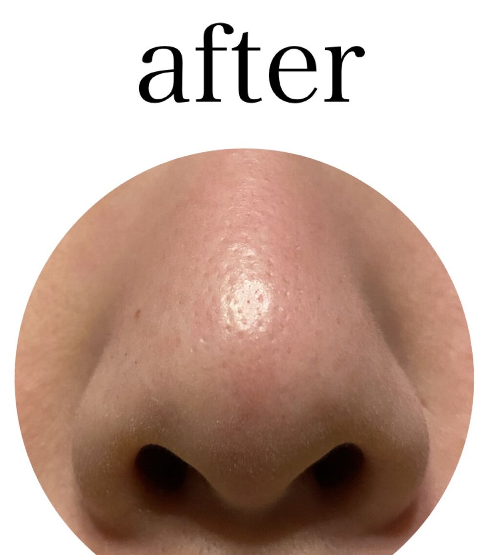 ガスール固形/ナイアード/洗顔石鹸 by 投稿ある方フォロバ100/ コッペ。