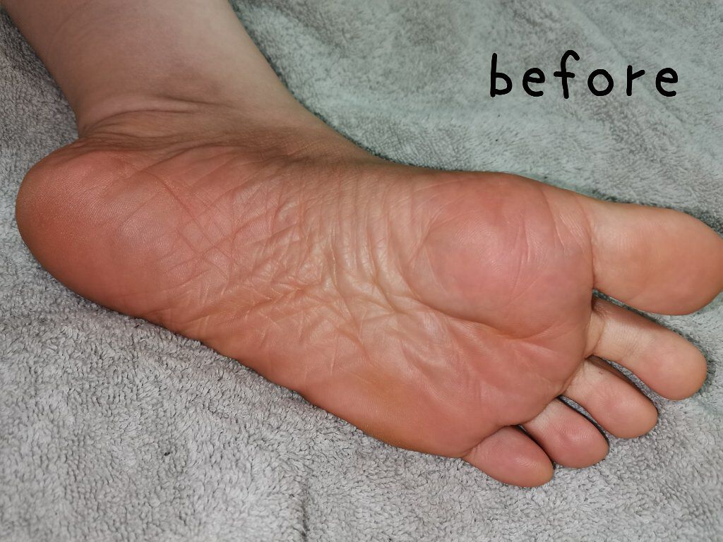 bea&#39;s up フットピーリングパック ペロリン グレープフルーツ/素数/レッグ・フットケアを使ったクチコミ（3枚目）