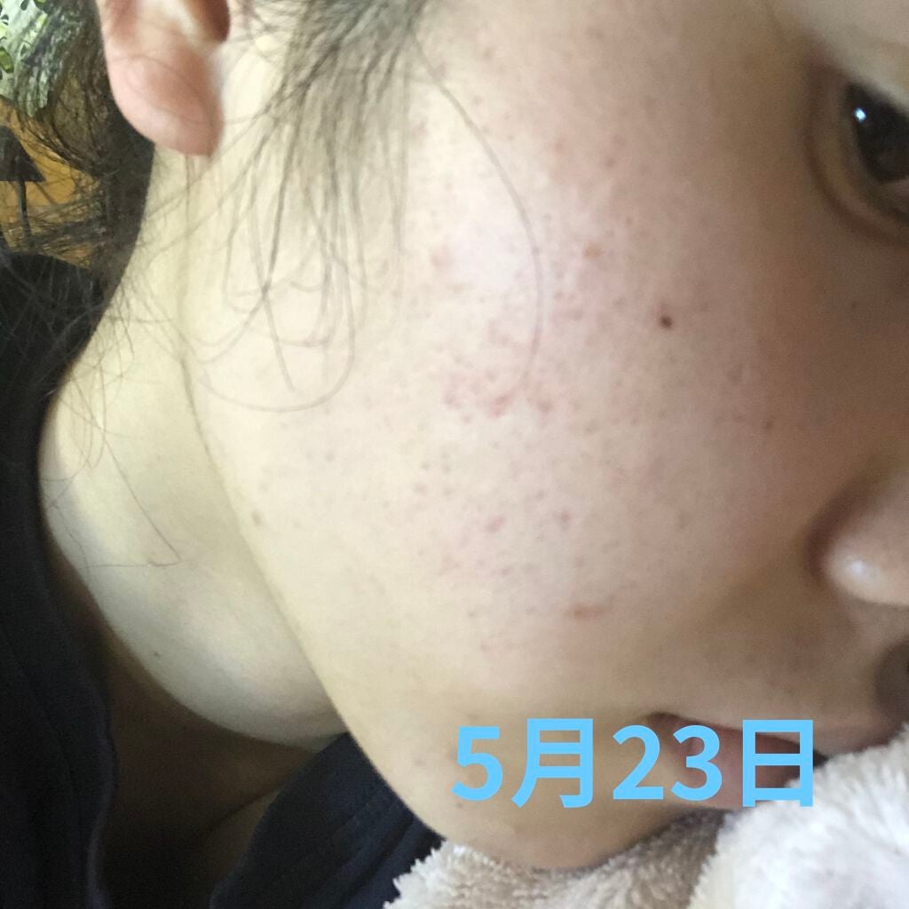 奏 on LIPS 「5月日記こうして見るとあんまり変わらない気がする笑笑今オードム..」(6枚目)