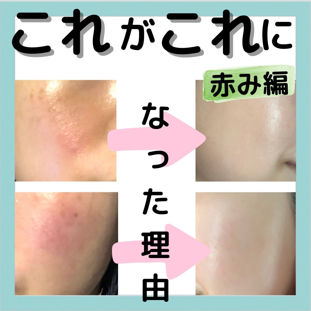 カワラヨモギ化粧水/ONE THING/化粧水を使ったクチコミ(1枚目)