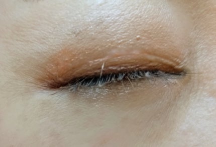 メザイク イージークリア 接着クリアタイプ/メザイク/二重まぶた用アイテムを使ったクチコミ(5枚目)