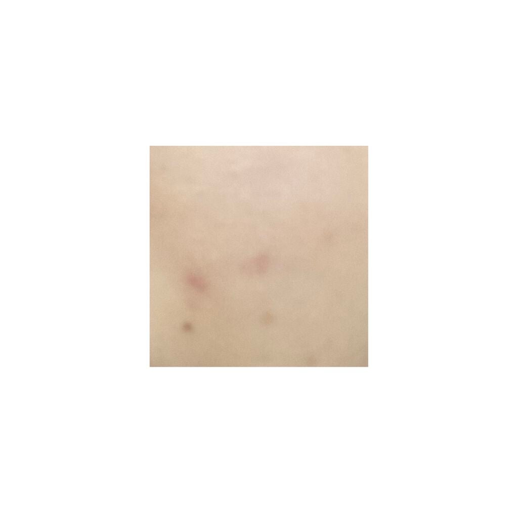 【旧】ディオールスキン フォーエヴァー スキン コレクト コンシーラー/Dior/リキッドコンシーラーを使ったクチコミ(6枚目)