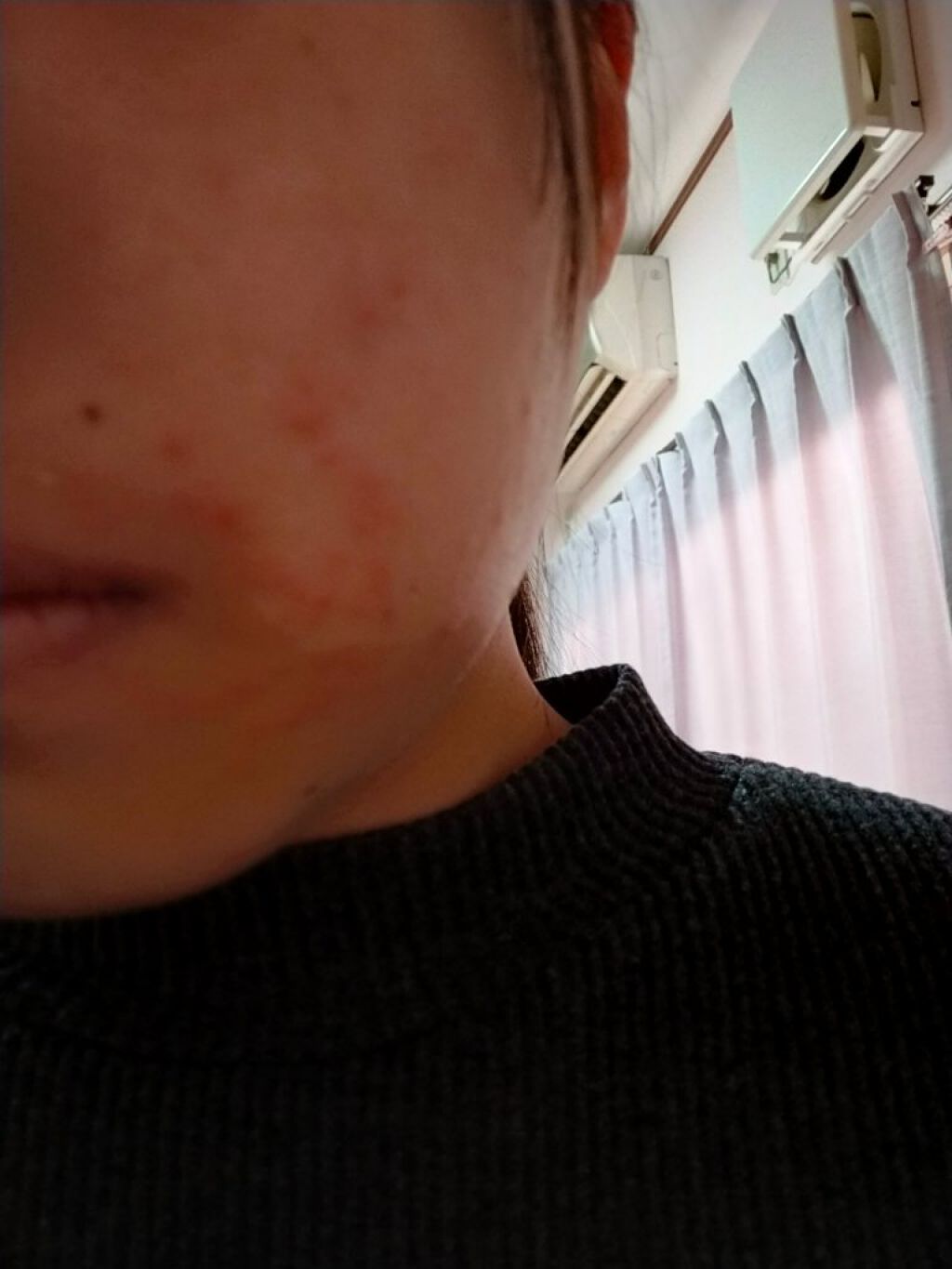  お米の化粧水N /毛穴撫子/化粧水を使ったクチコミ（2枚目）