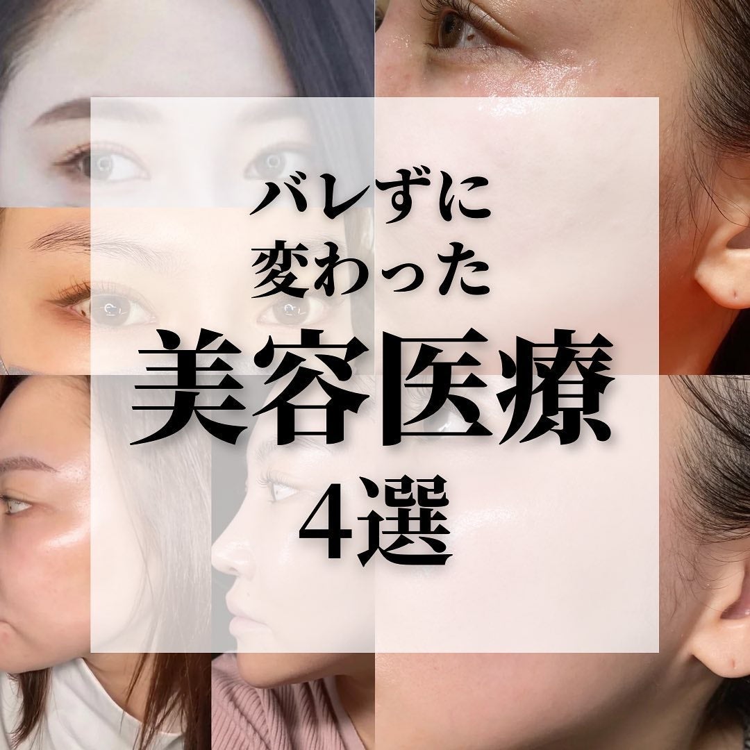 miriïŒã¿ãïŒðŒ on LIPS ãä»å¹Žãã£ãŠè¯ãã£ãçŸå®¹å»çïŒãããããšãäžè©±ã«ãªããŸããðå³..ãïŒ1æç®ïŒ