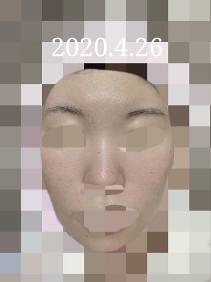 クリアトライアルセット M(しっとりタイプ)/オルビス/トライアルキットを使ったクチコミ(1枚目)