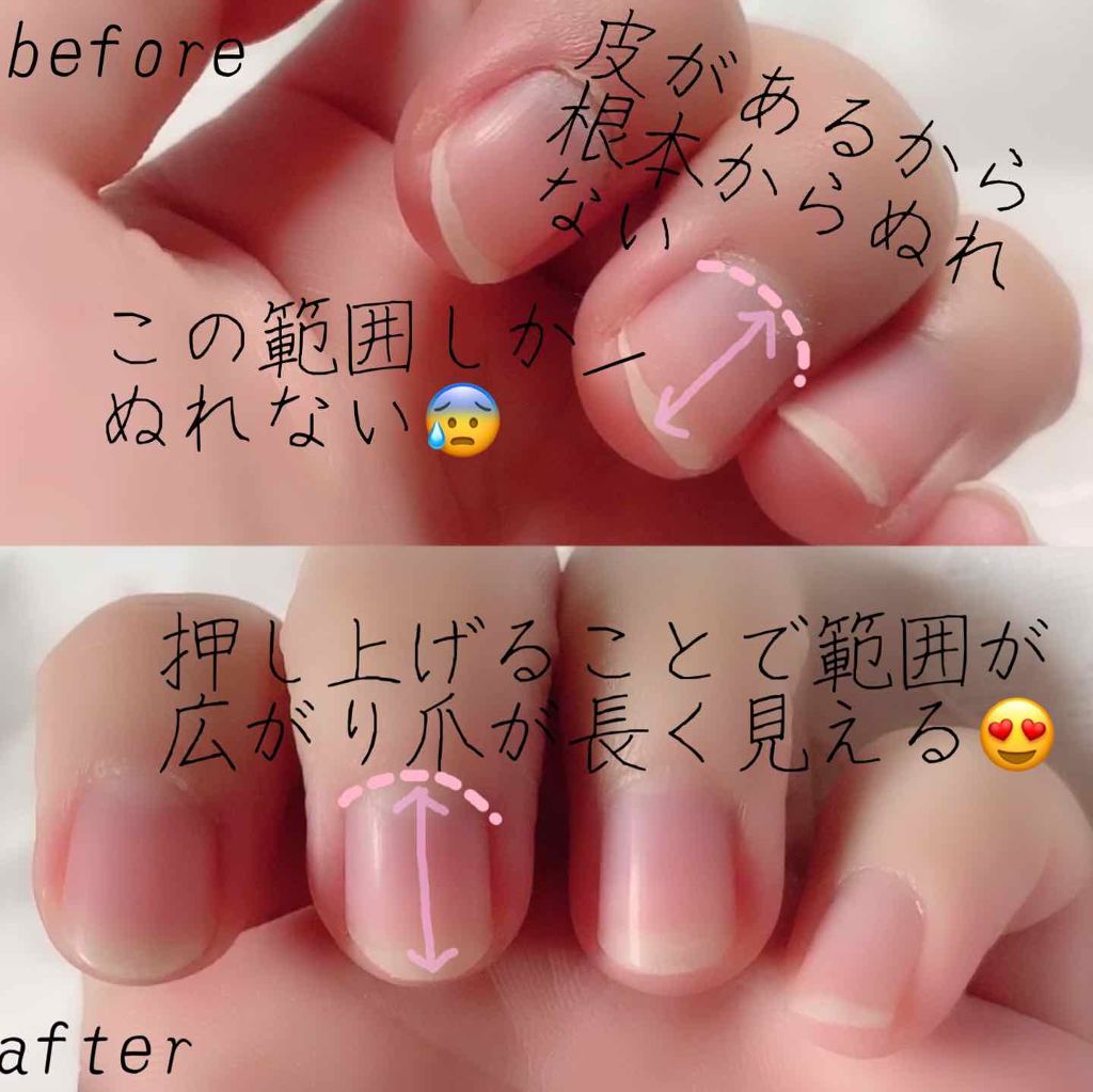 キューティクルスクレイパー スリム デュカートの口コミ 私の甘皮処理方動画あり 爪が長く見え見栄え By うさこ フォロバ 投稿ある方 乾燥肌 Lips