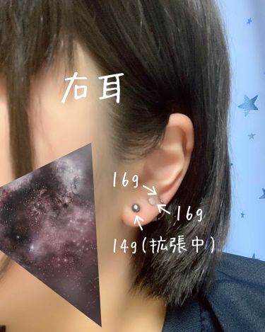ドルマイシン軟膏 医薬品 ゼリア新薬工業を使った口コミ この春 中学や高校を卒業して また一段と新 By ゆーり 10代後半 Lips