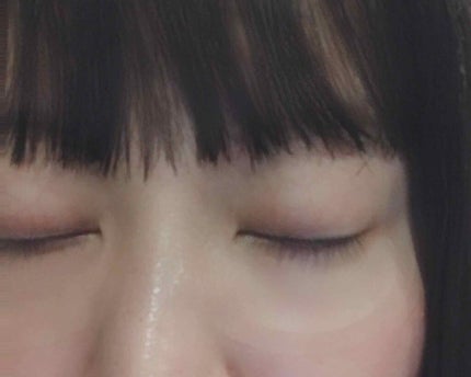 シロバリモイストパッチ/sirobari/シートマスク・パックを使ったクチコミ(4枚目)