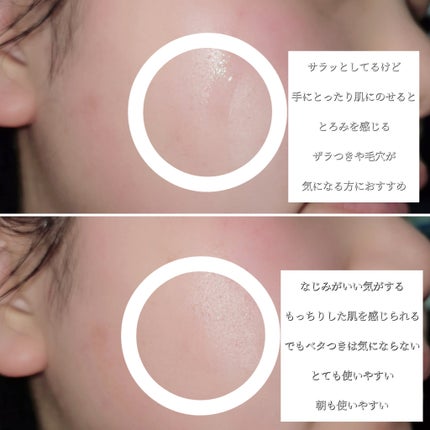 エファクラ ピールケア セラム/ラ ロッシュ ポゼ/美容液を使ったクチコミ(4枚目)