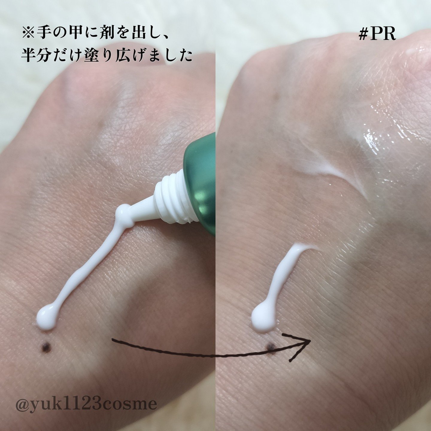 HiCA　AZAリペアクリーム アゼライン酸10%/HiCA/フェイスクリームを使ったクチコミ（3枚目）