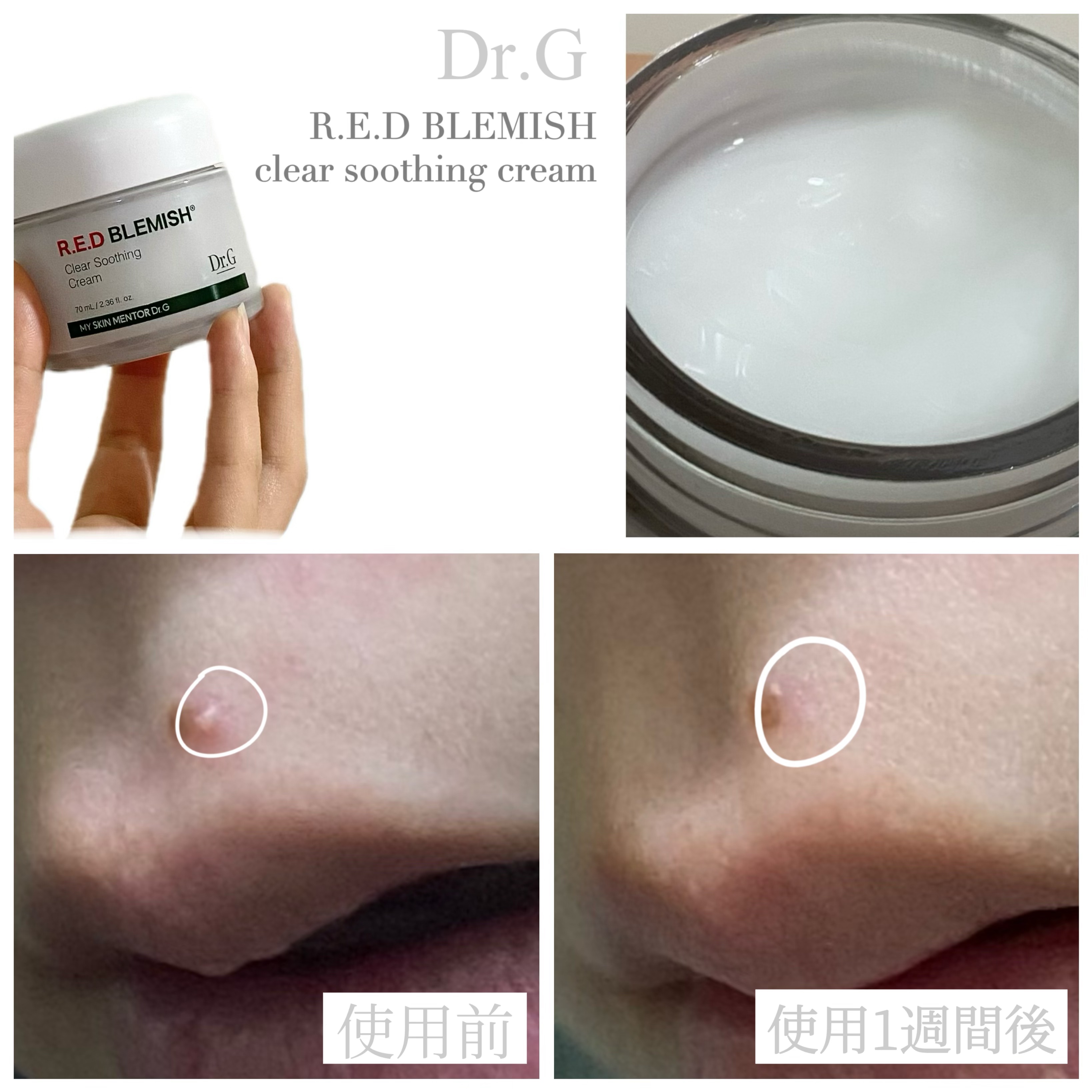 レッドブレミッシュ クリアスージングクリーム/Dr.G/フェイスクリームを使ったクチコミ（2枚目）