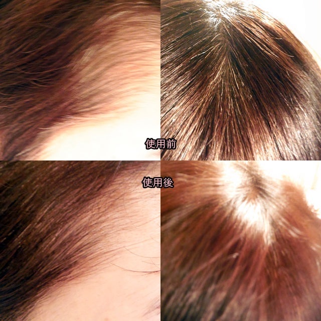 クレイスパ カラートリートメント/clayence/ヘアカラーを使ったクチコミ(3枚目)