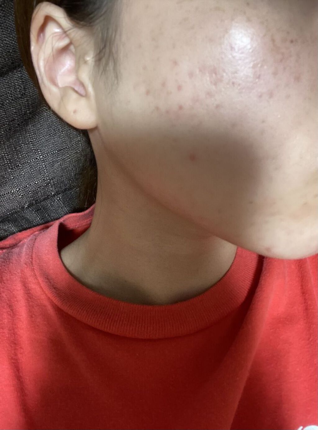 ブライト＆バウンシングローション（ノーマルタイプ）/ジュレリッチ/化粧水を使ったクチコミ（1枚目）