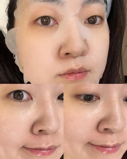 ãªã¢ã·ã¹ ã¹ãŒãžã³ã° ãã¹ã¯/Dr.Althea/ã·ãŒããã¹ã¯ã»ããã¯ã䜿ã£ãã¯ãã³ãïŒ5æç®ïŒ